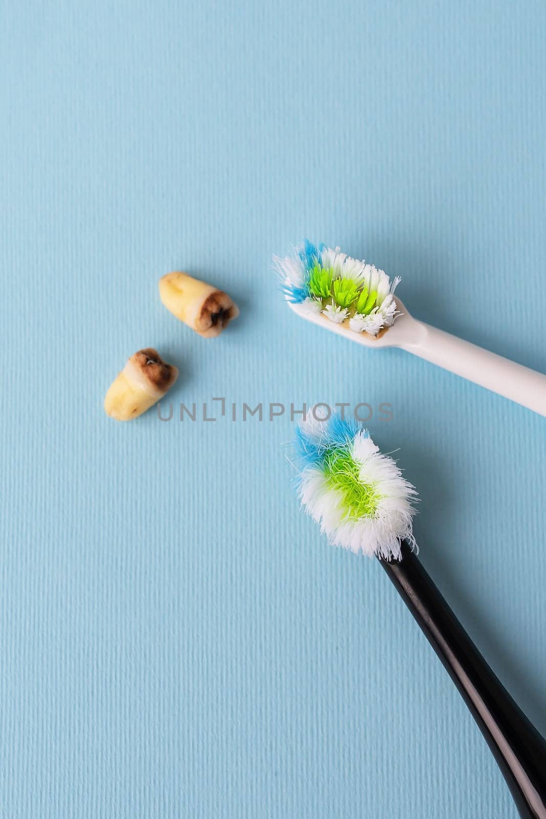 A modern electric toothbrush on a blue background next to extracted wisdom teeth affected by caries. Tooth extraction operation. Hygiene concept for daily care