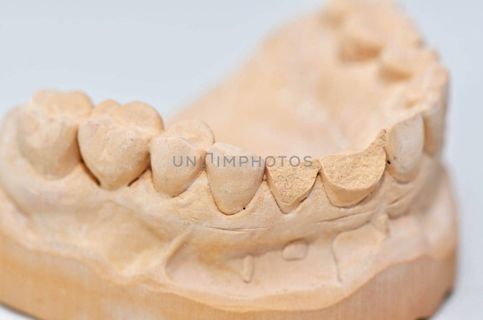 Teeth