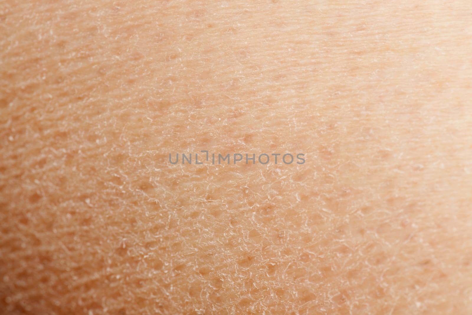 A macro detail background of dry skin