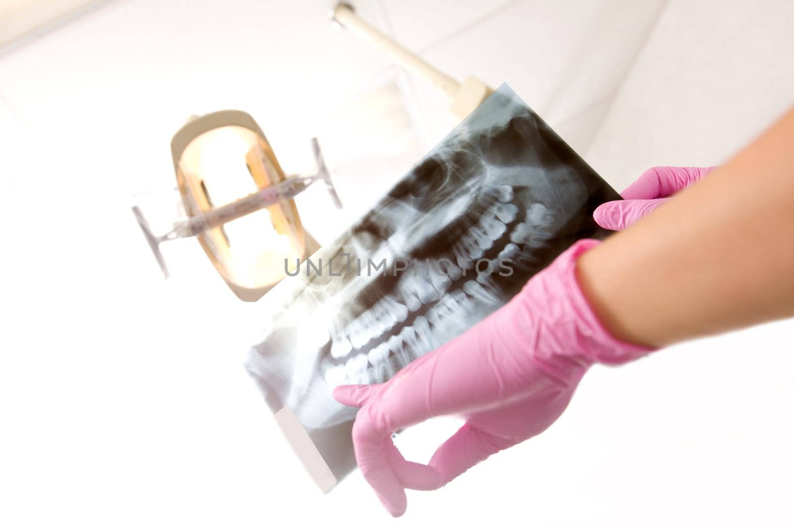 A dentist's hand holding up an x-ray for the patient