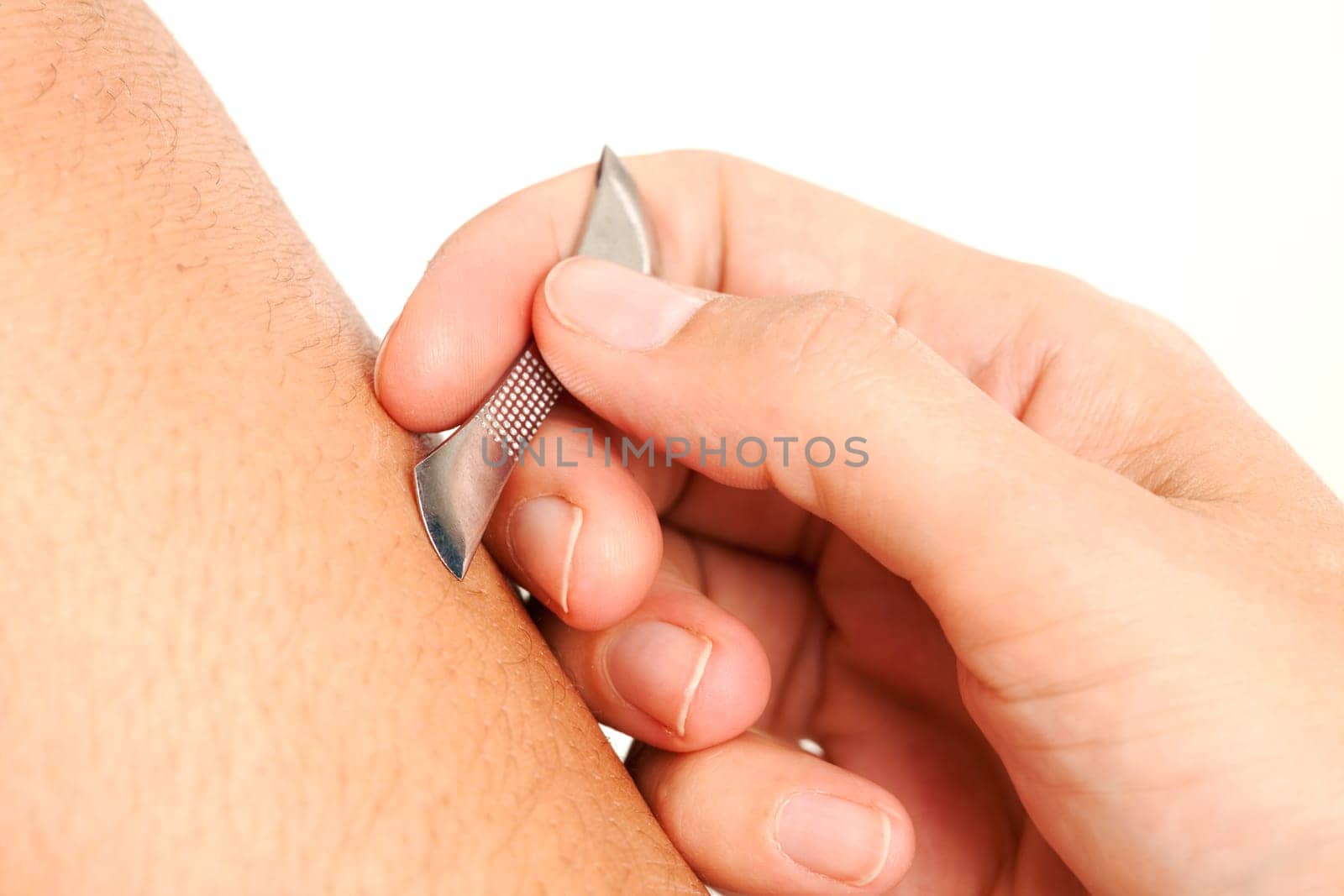 Detail of a Choto, a Japanese Pediatric Acupuncture tool being used on the leg of a young male.
