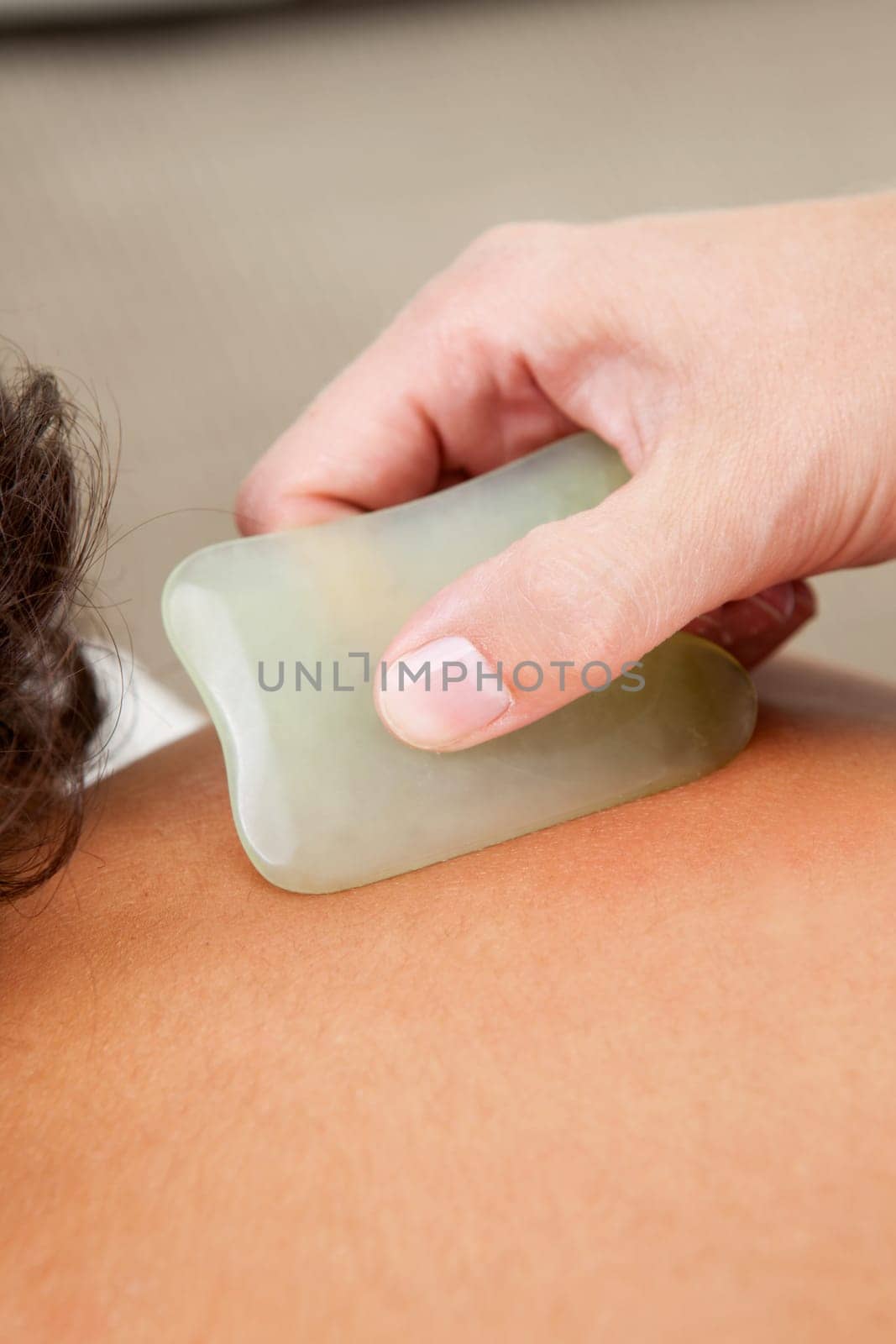 Detail of back fo young male receiving gua sha acupuncture treatment