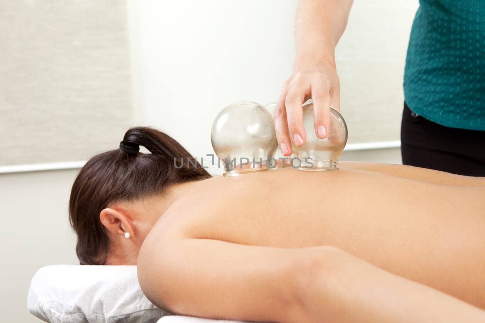 Woman receiving a cupping treatment at an acupuncture clinic