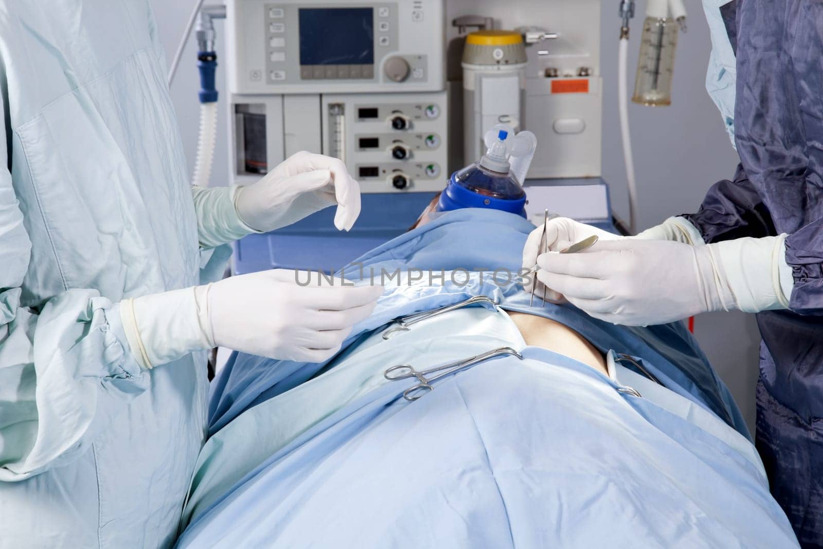 Closeup of a surgery in the operation theatre