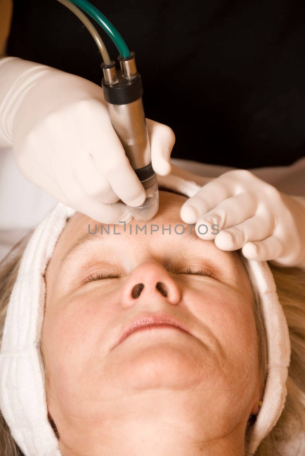 older woman getting electrolysis on he face