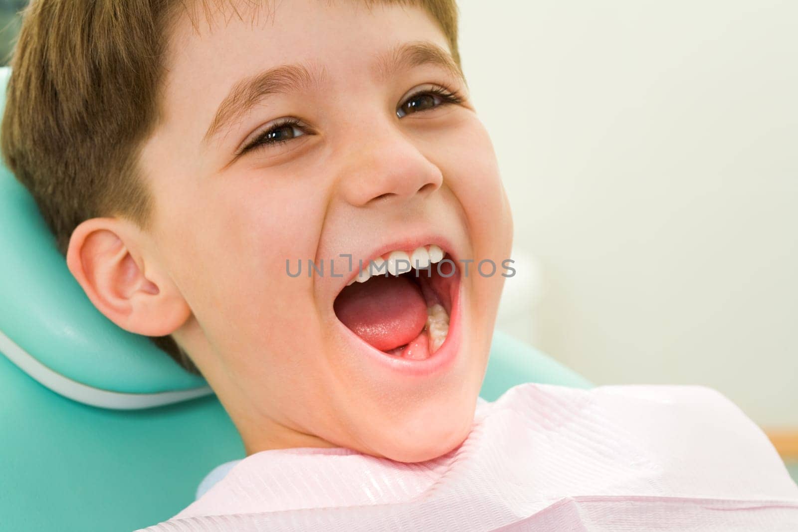 Photo of youngster with his mouth wide open during checkup at the dentists