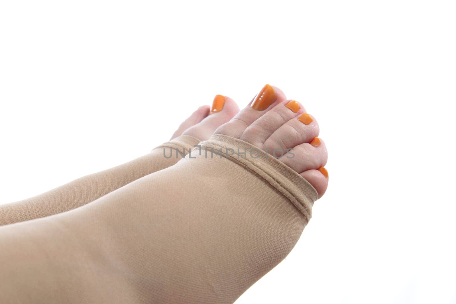 details of feet of a pregnant woman with a compression stocking