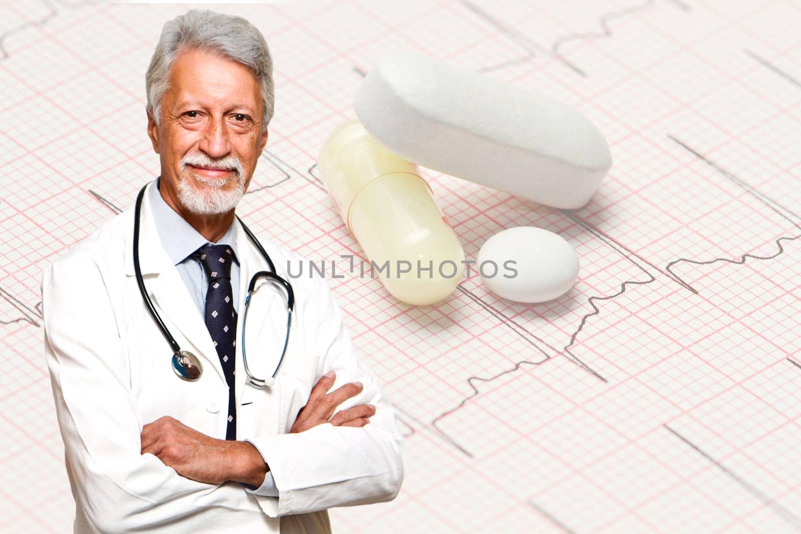 electrocardiogram