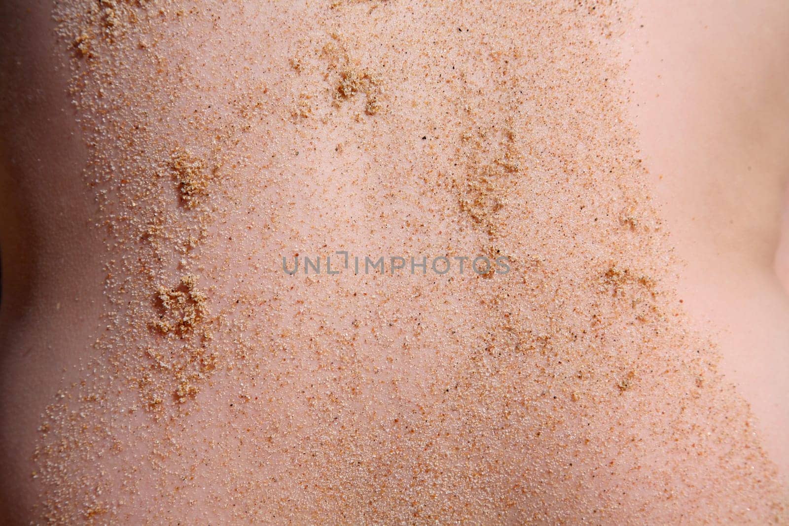 Sandy skin