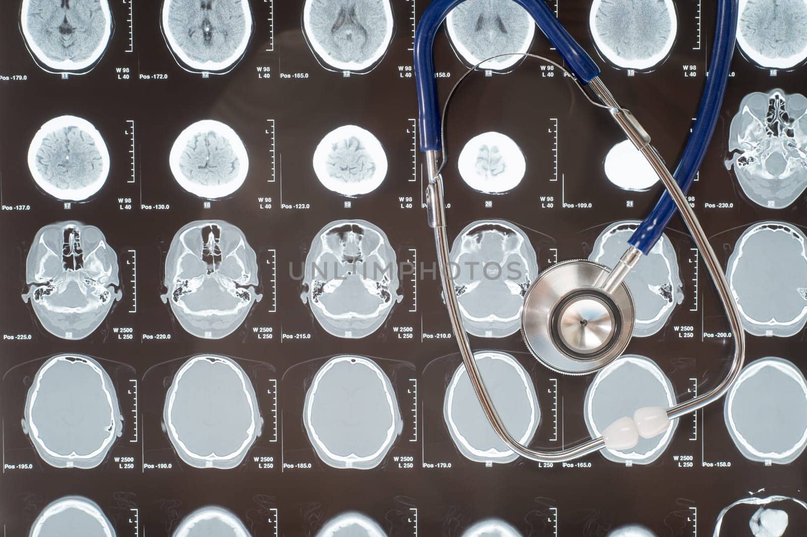 Stethoscope lying over medical head x-ray