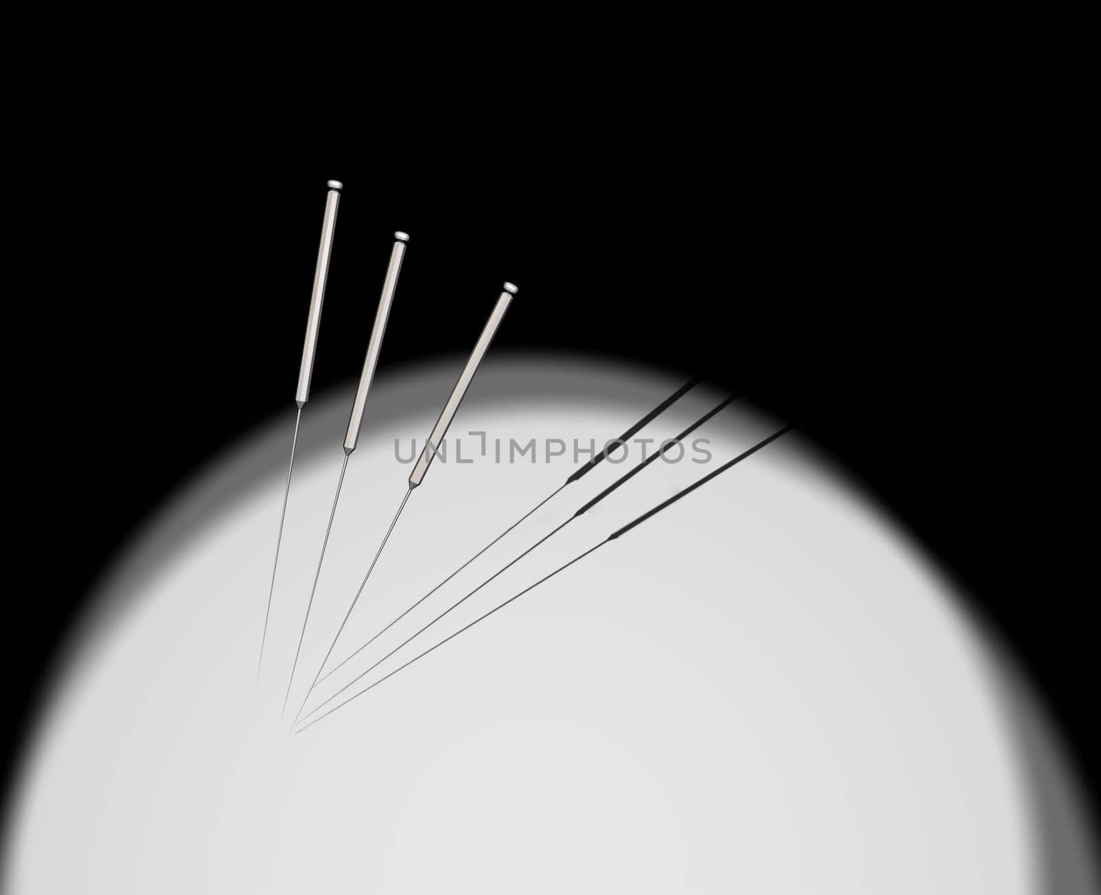 Acupuncture