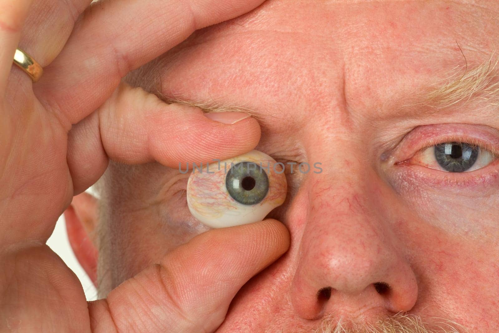 Glass Eye in Detail