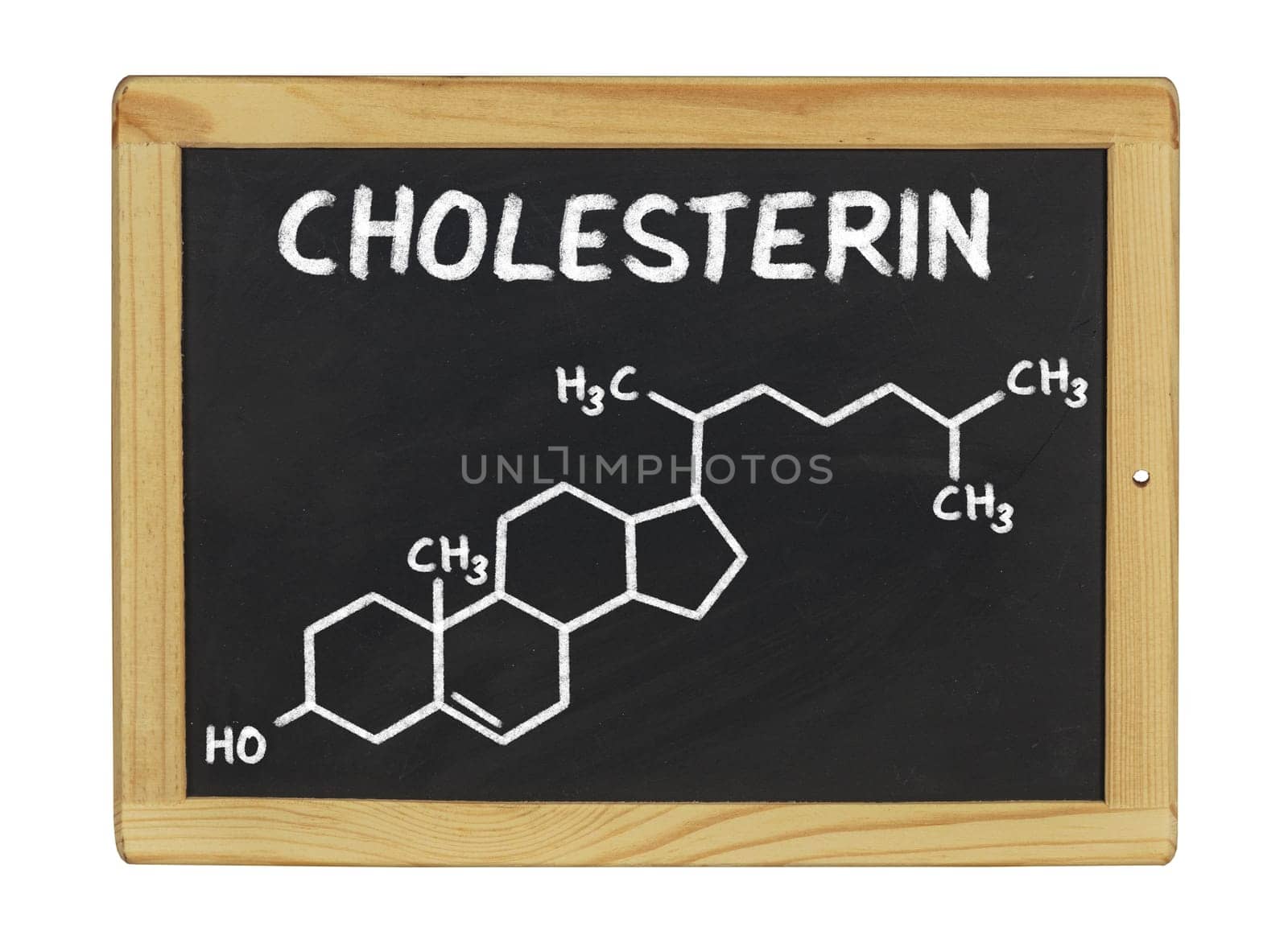 chemical structural formula of cholesterol on a slate