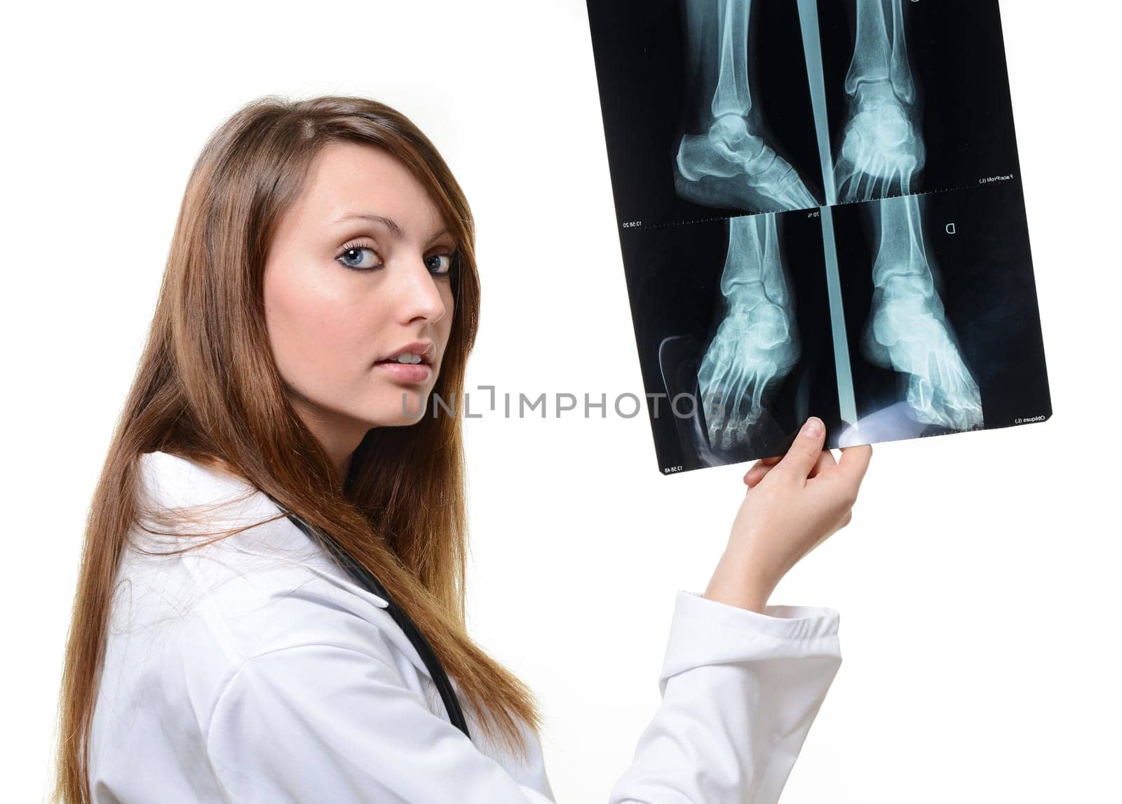 female doctor with x-ray in hand over a white background