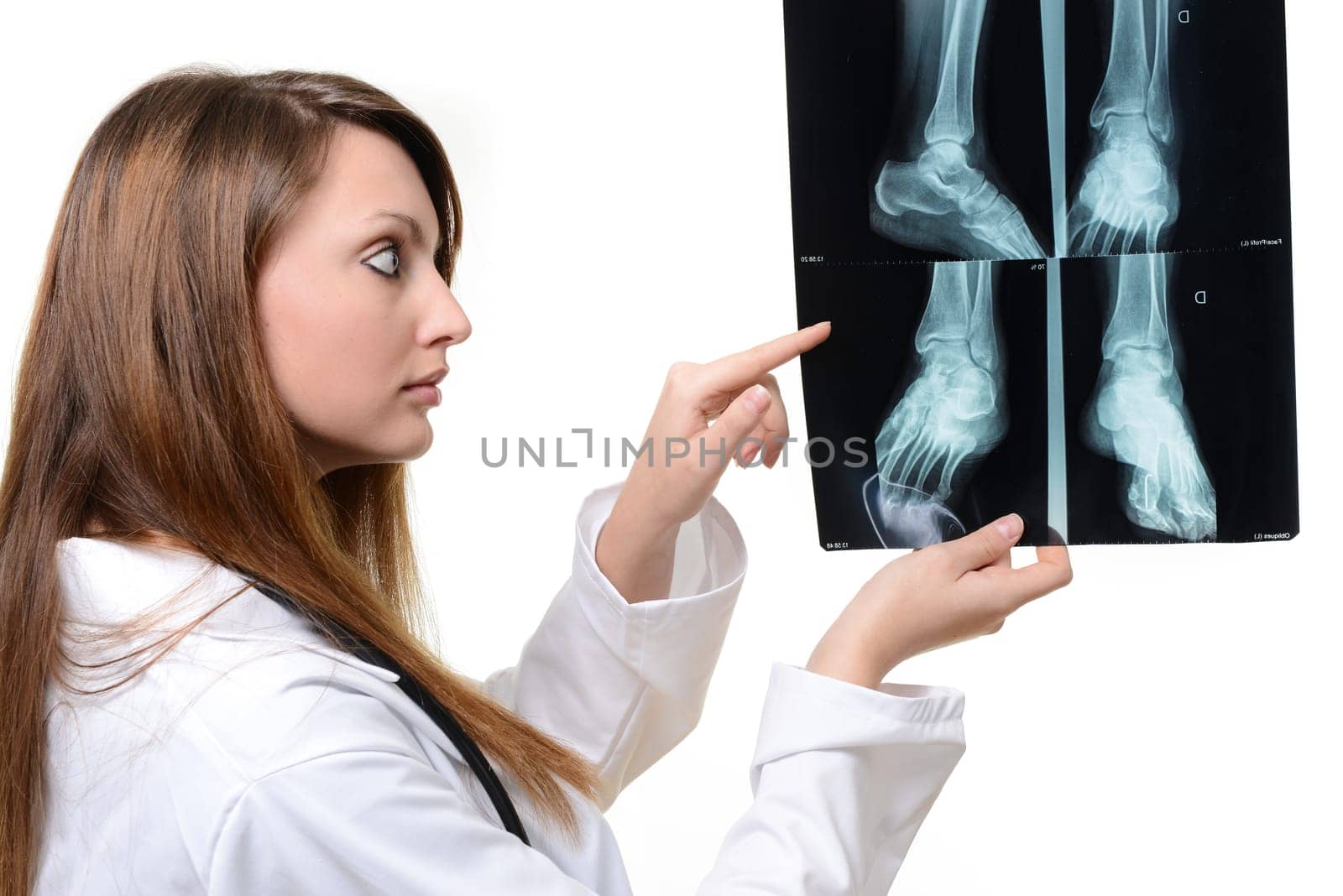 female doctor with x-ray in hand over a white background