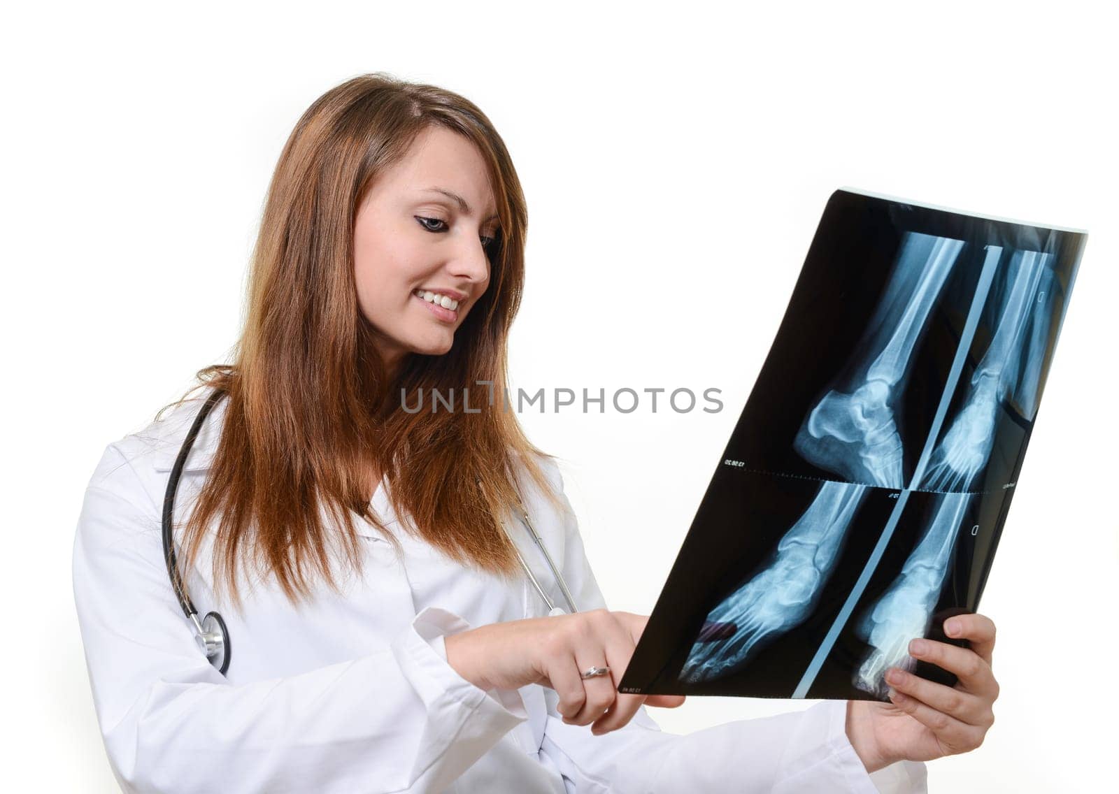 female doctor with x-ray in hand over a white background