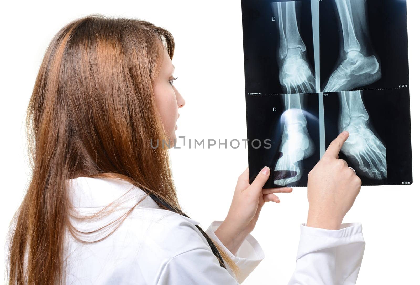female doctor with x-ray in hand over a white background