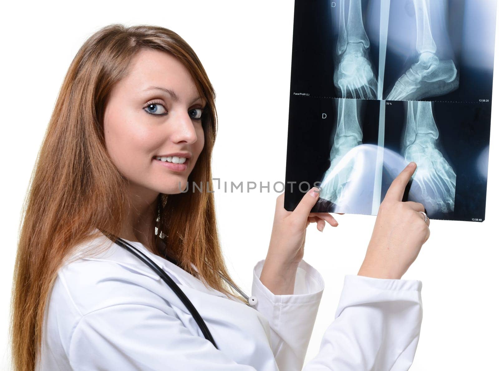 female doctor with x-ray in hand over a white background