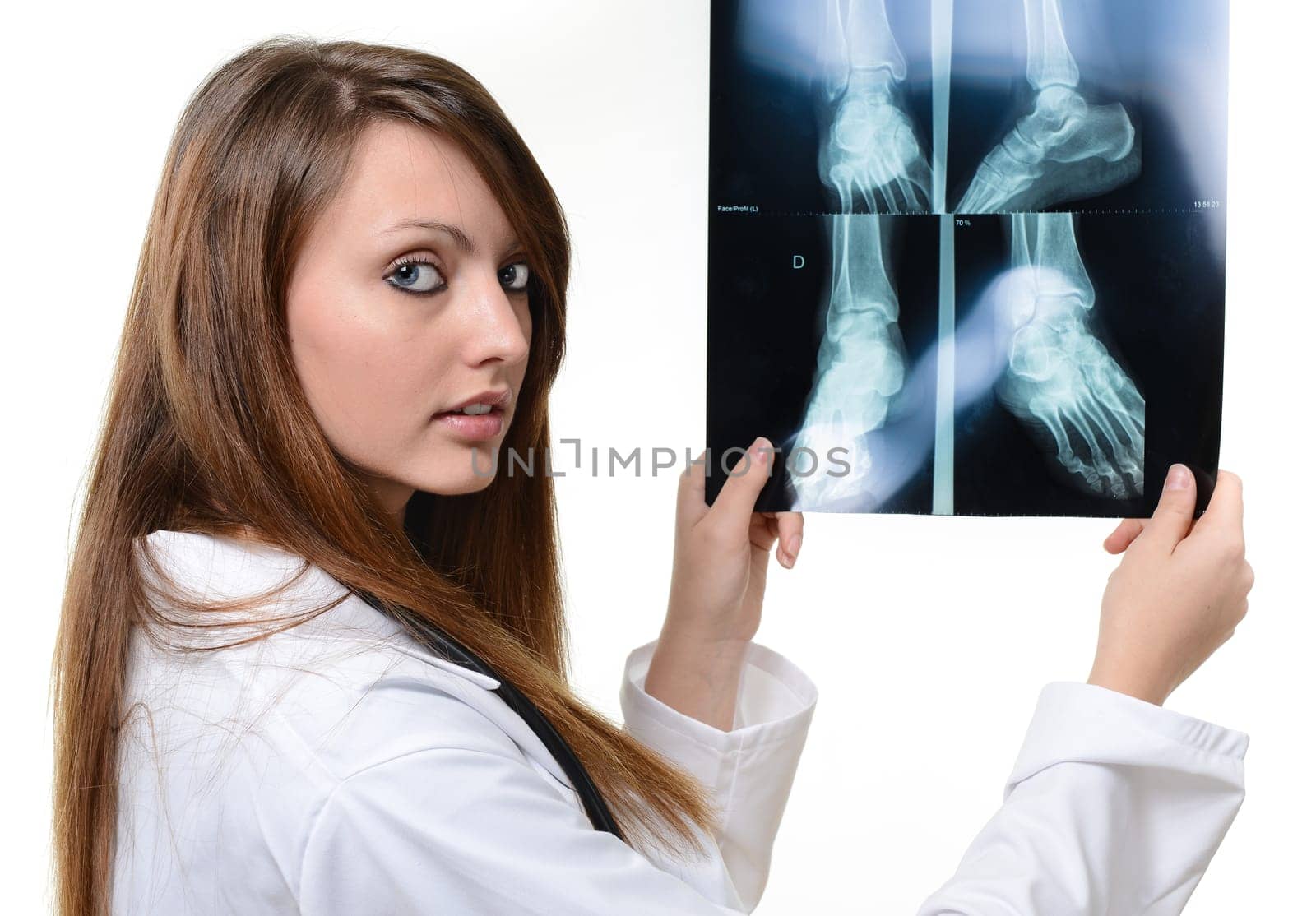 female doctor with x-ray in hand over a white background