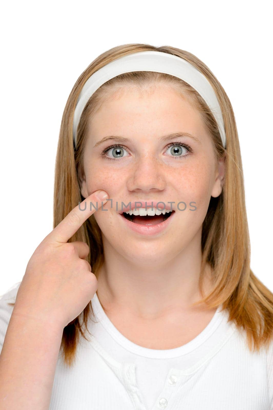 Young blonde teenager looking showing skin care problem acne