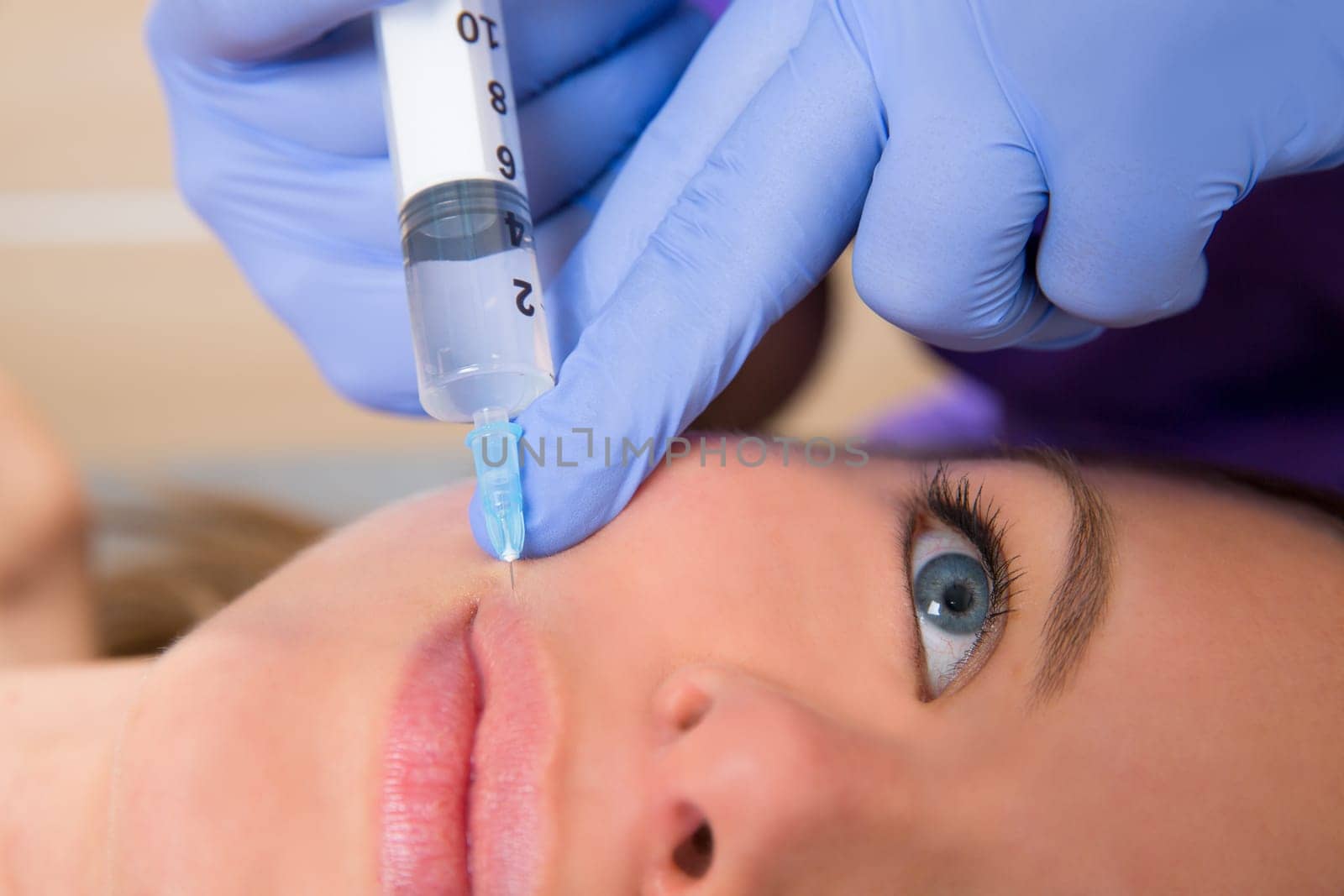 Anti aging facial mesotherapy with syringe closeup  on woman face rictus