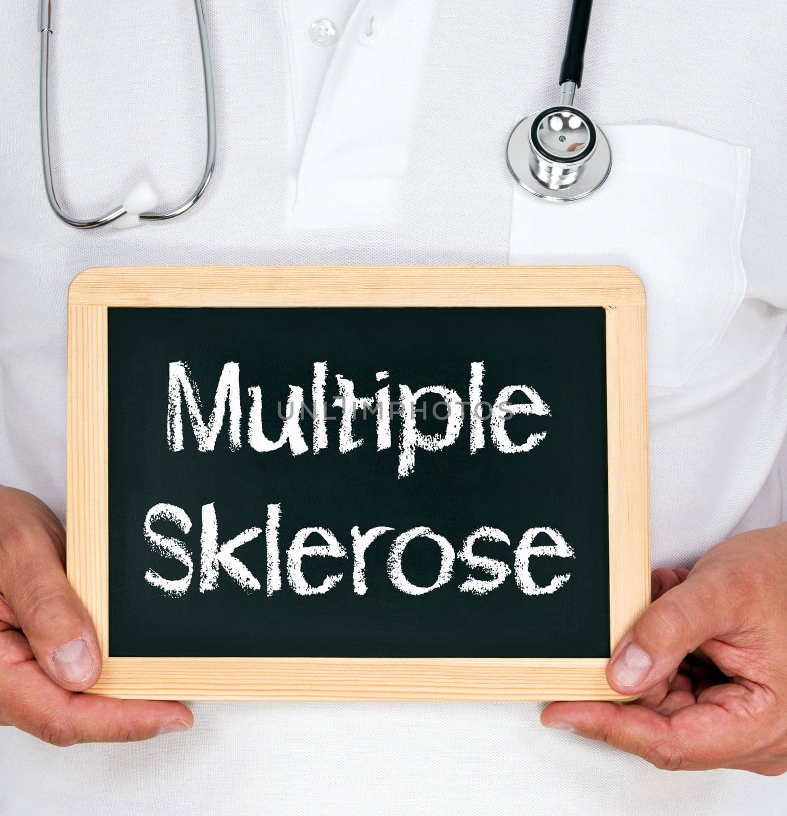 Multiple sclerosis