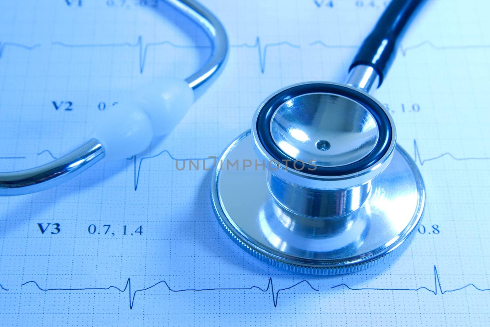 Stethoscope on EKG printout