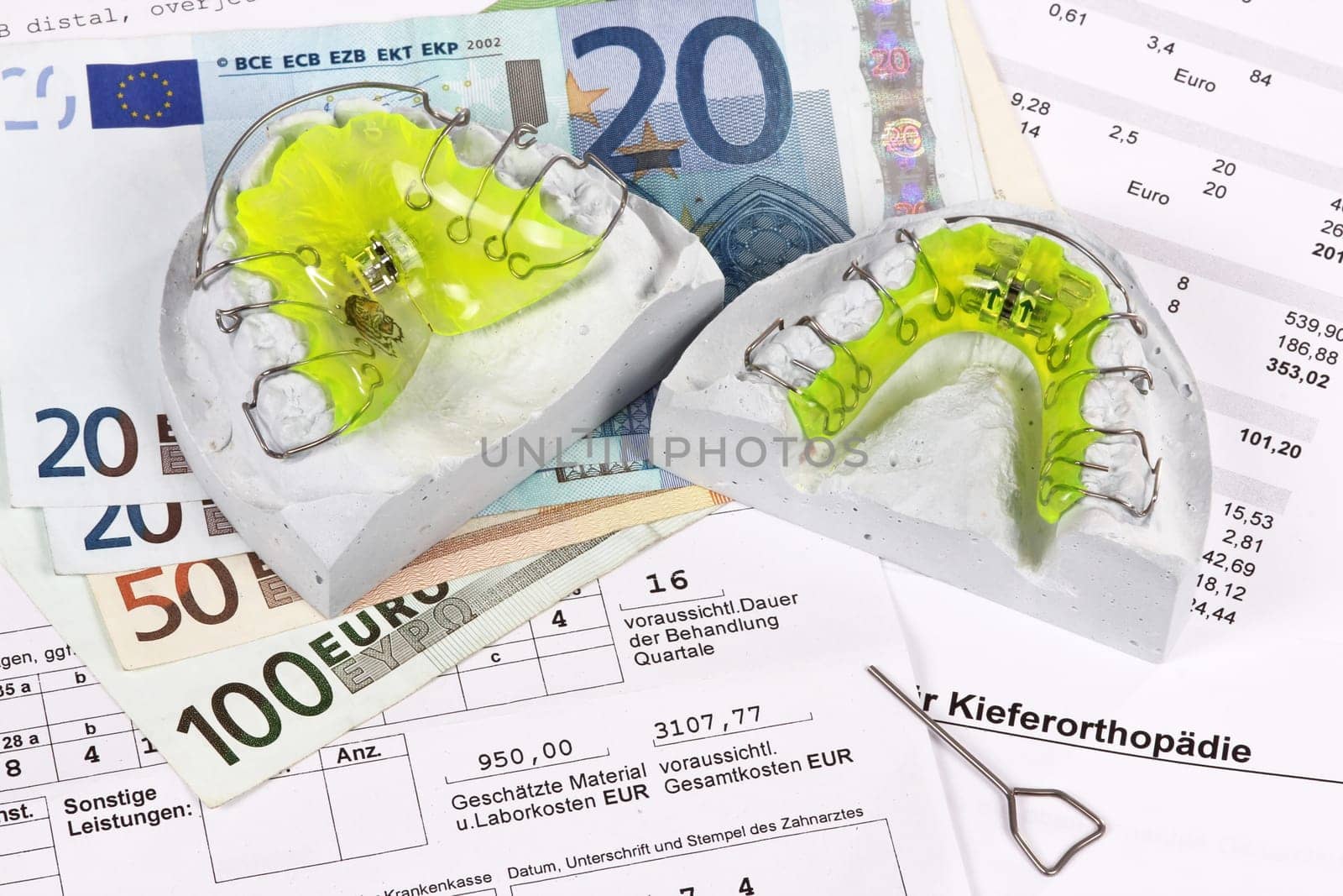 Cost plan braces,orthodontics