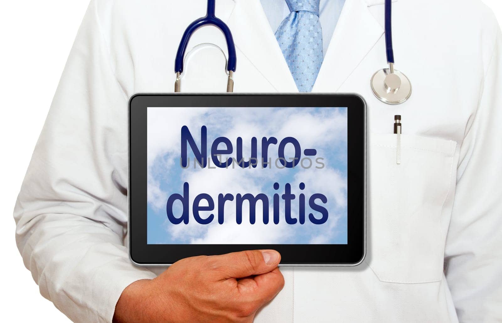 Neurodermatitis by DOC-Photo