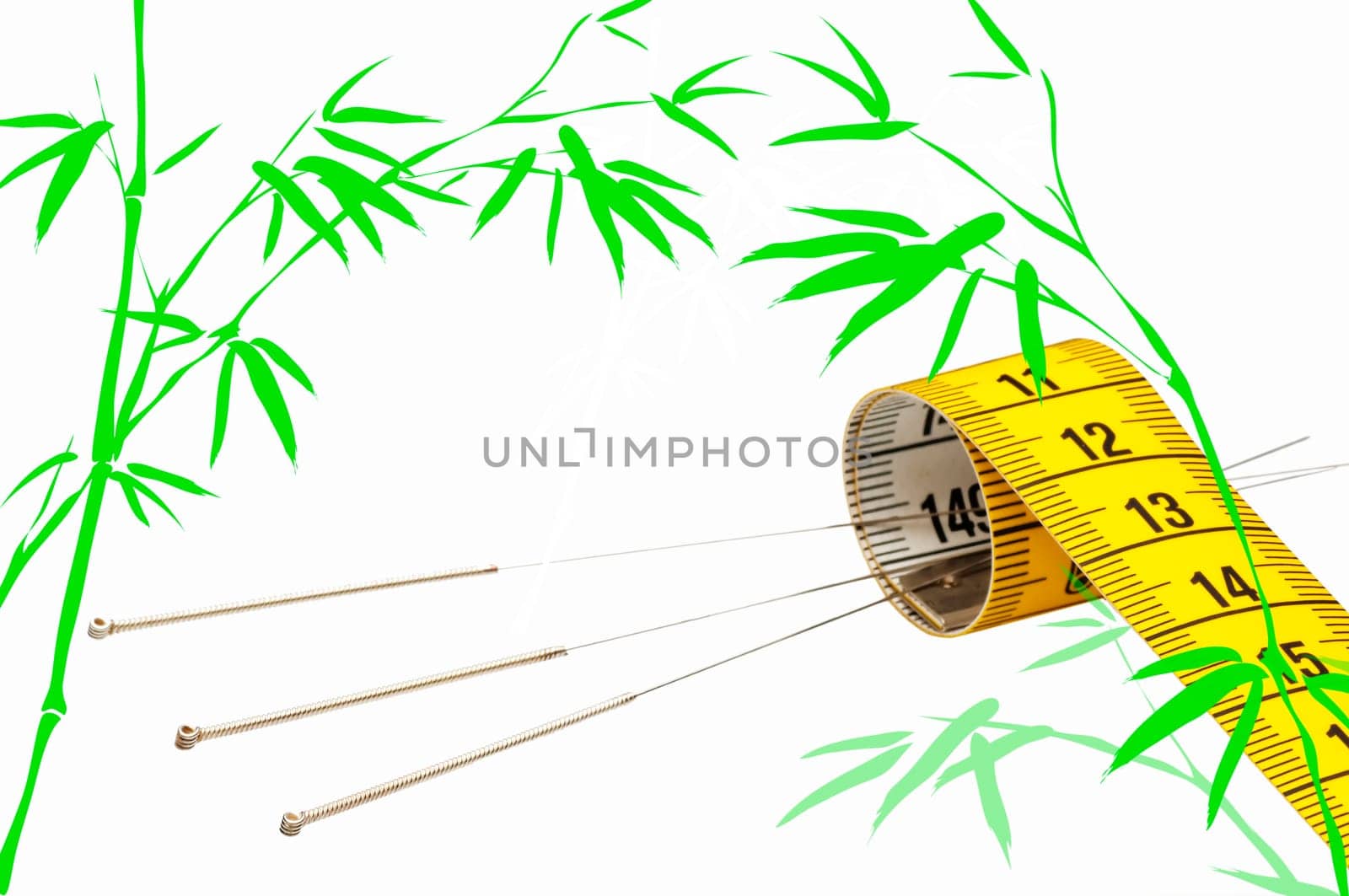 Acupuncture for weight loss