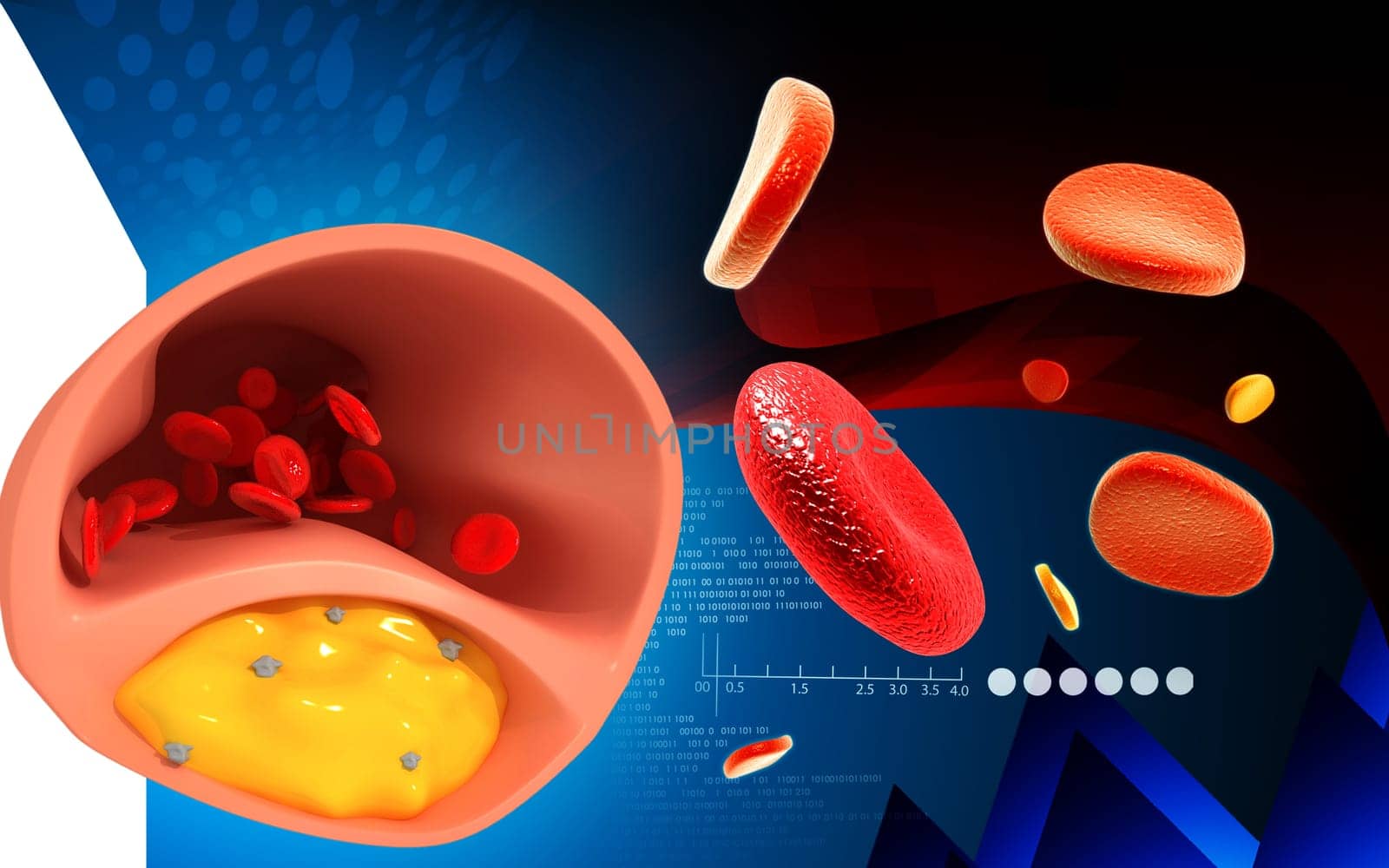 Digital illustration of Cogged arteries in colour background