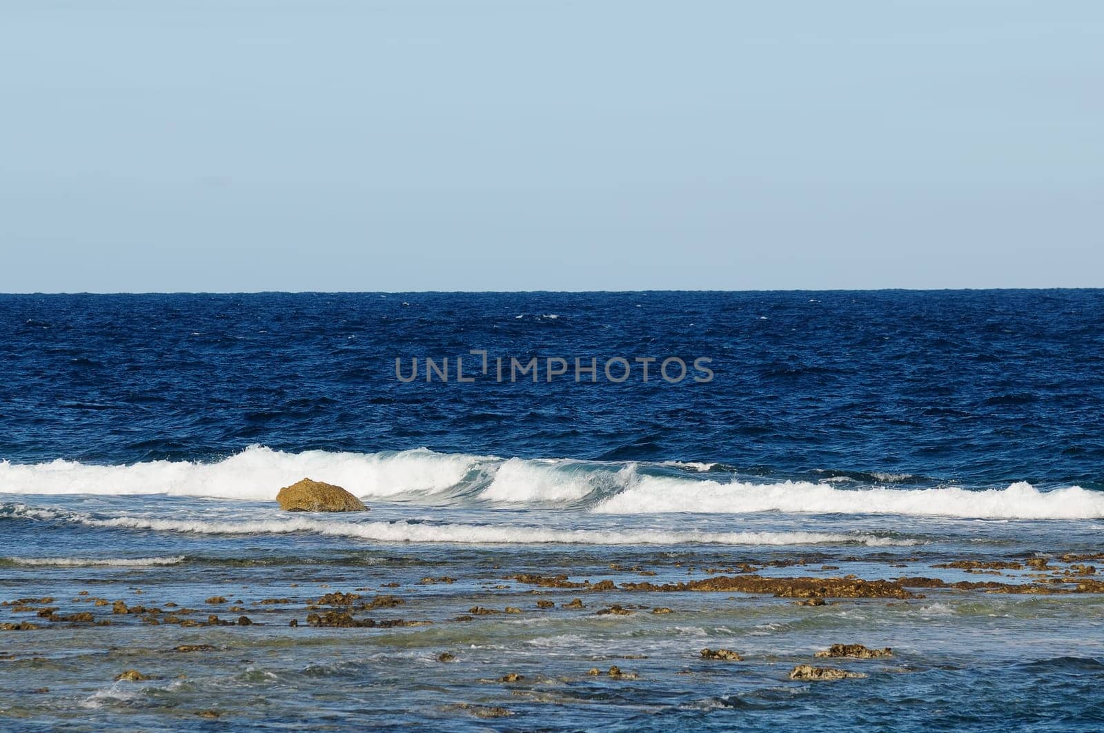 Gozo