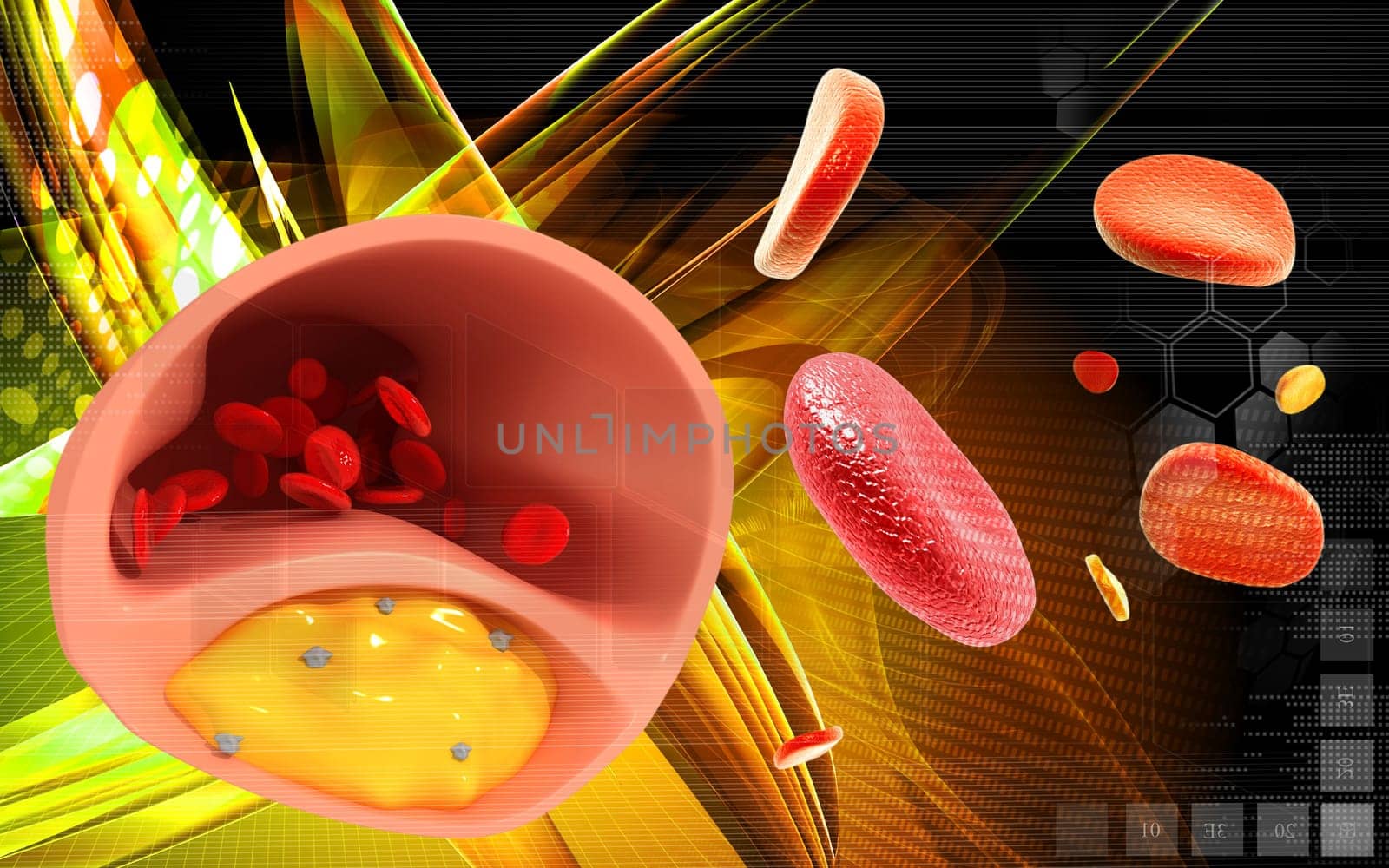 Digital illustration of Cogged arteries in colour background