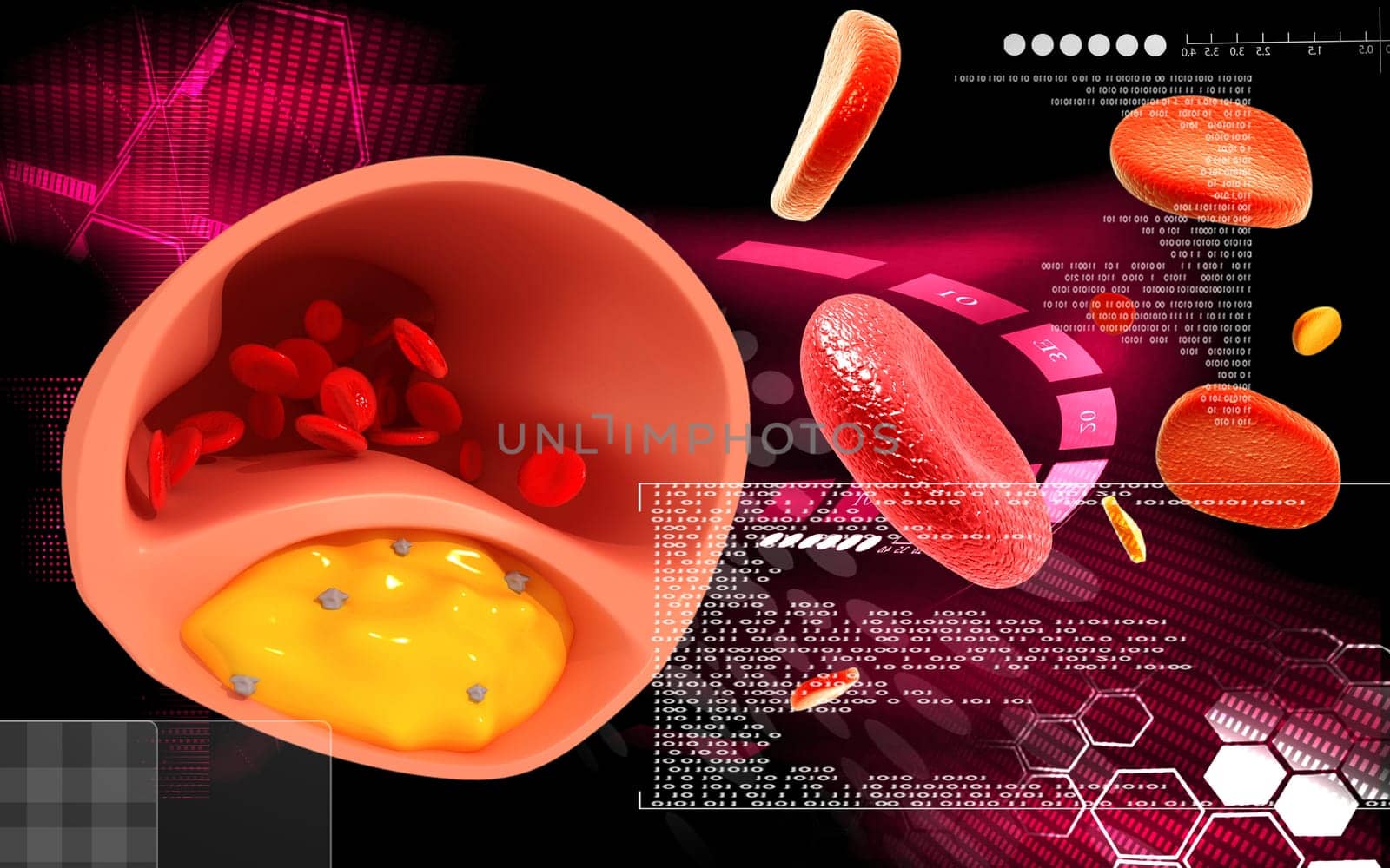 Digital illustration of Cogged arteries in colour background