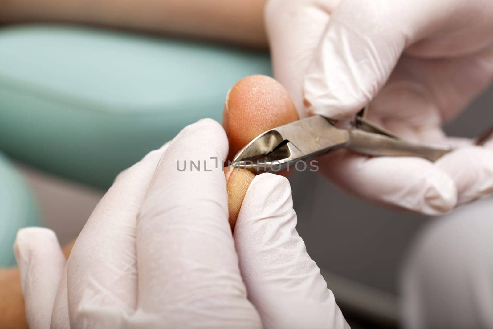 Toenails are trimmed with pliers