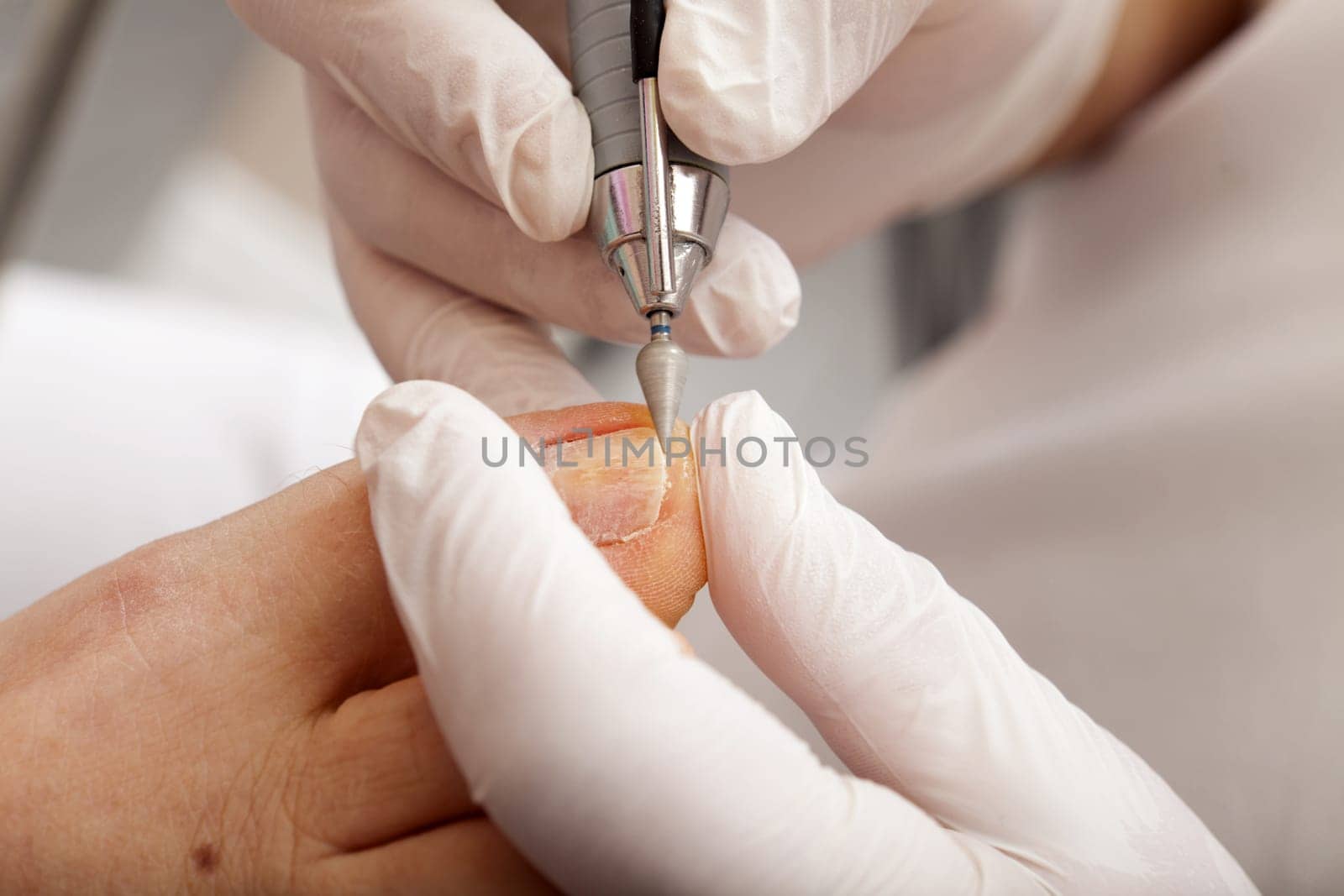 Foot care erabe when polishing toenails