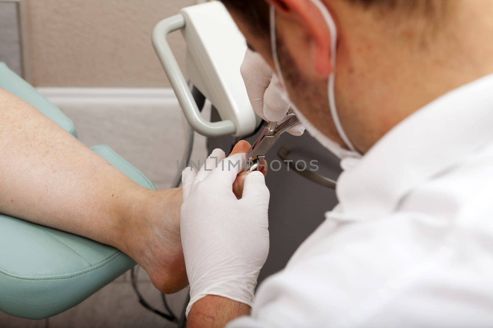 Foot care worker cuts toenails with pliers