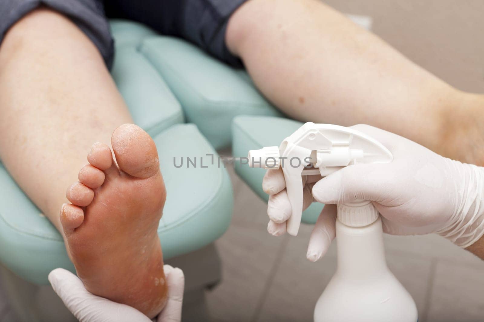 Feet are sprayed with cleaner