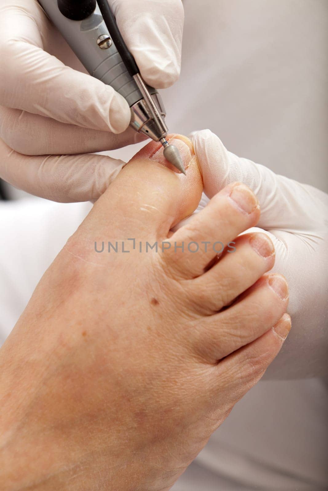 Surface of toe nails are polished