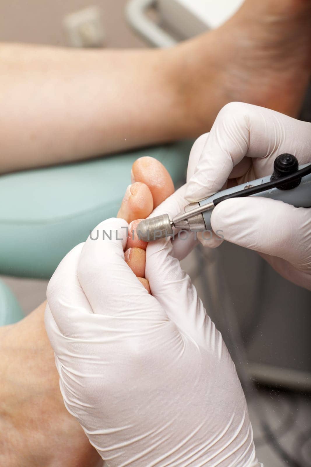 Foot care with a grinding machine in practice