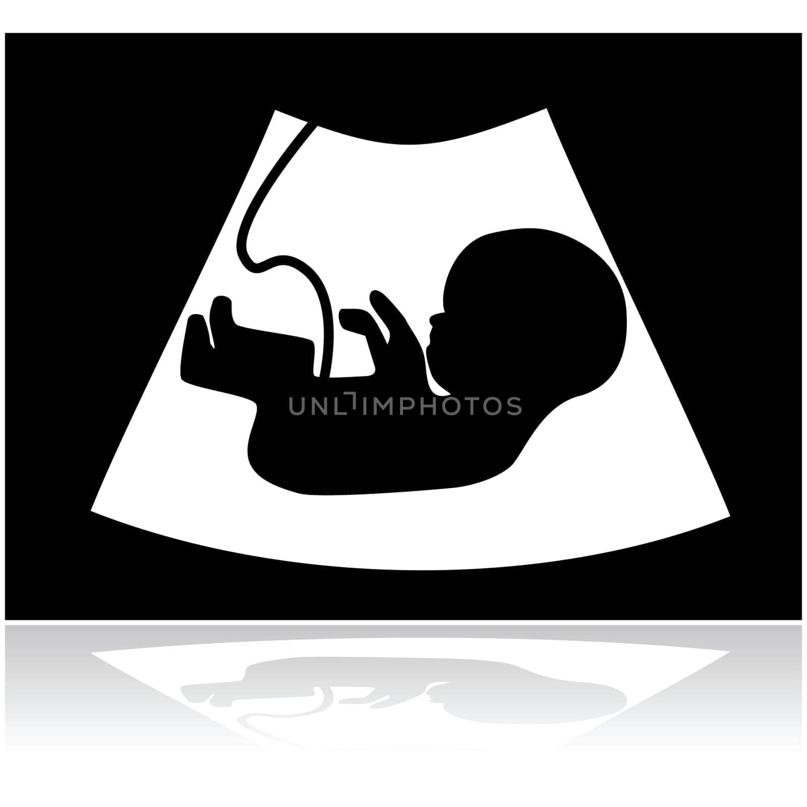 Concept illustration showing a baby inside a mother's womb in an ultrasound scan
