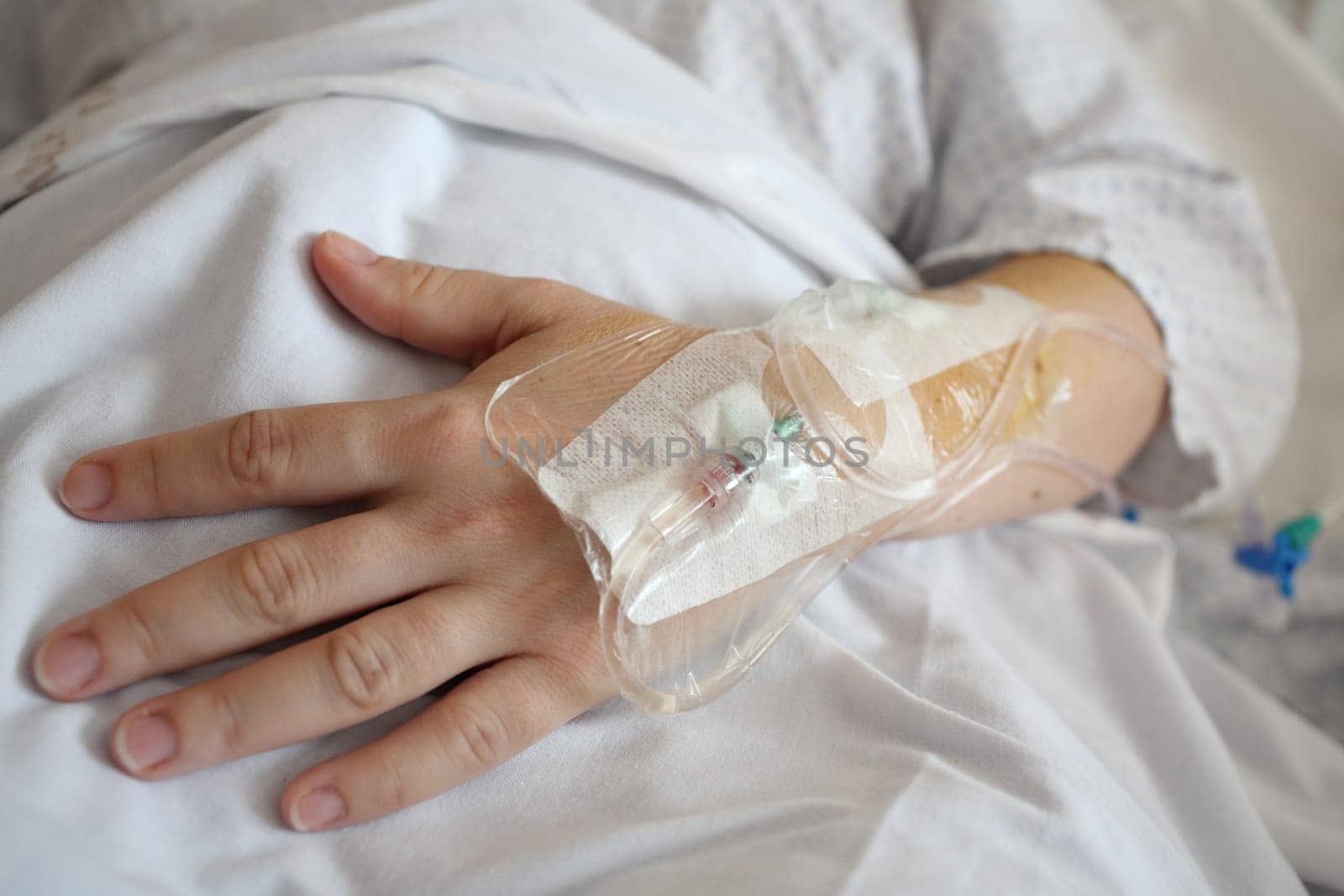 Details of an intravenous therapy with catheter