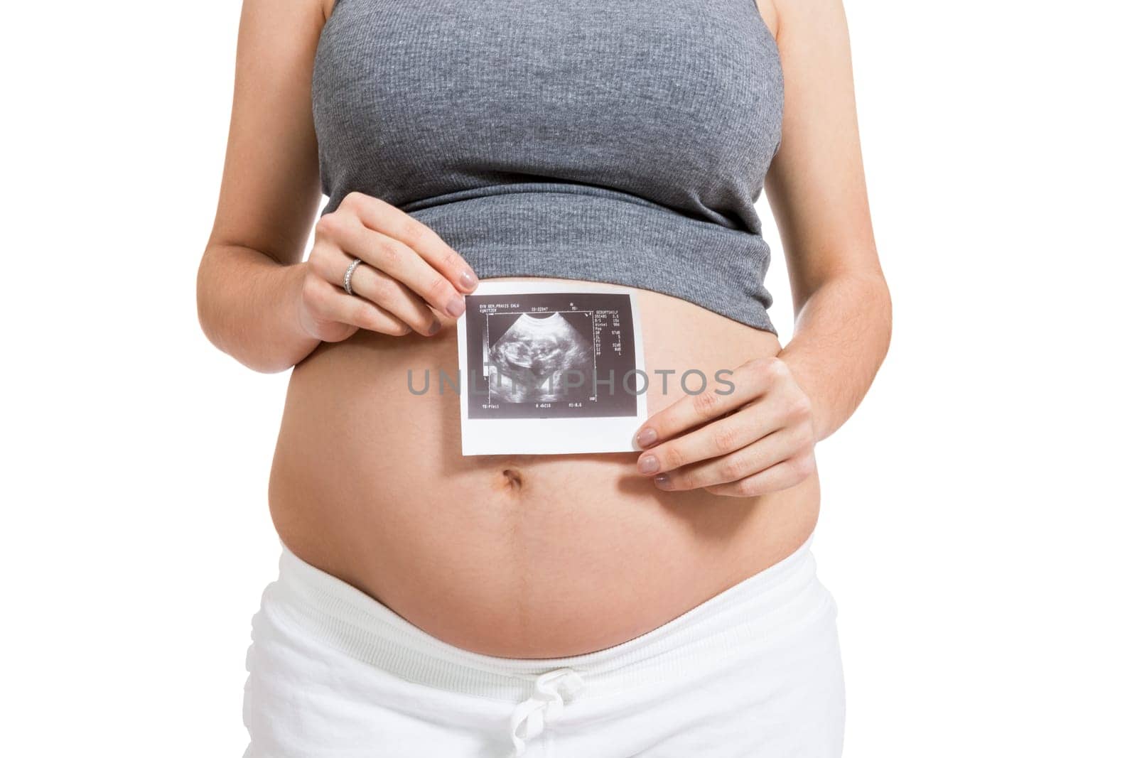 Young attractive woman with ultrasound image in hand pregnant isolated against white background
