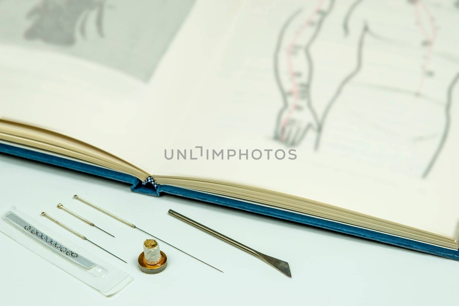 Acupuncture,Chinese medicine