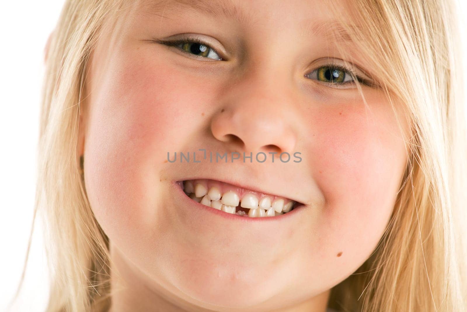 the little girl with missing teeth
