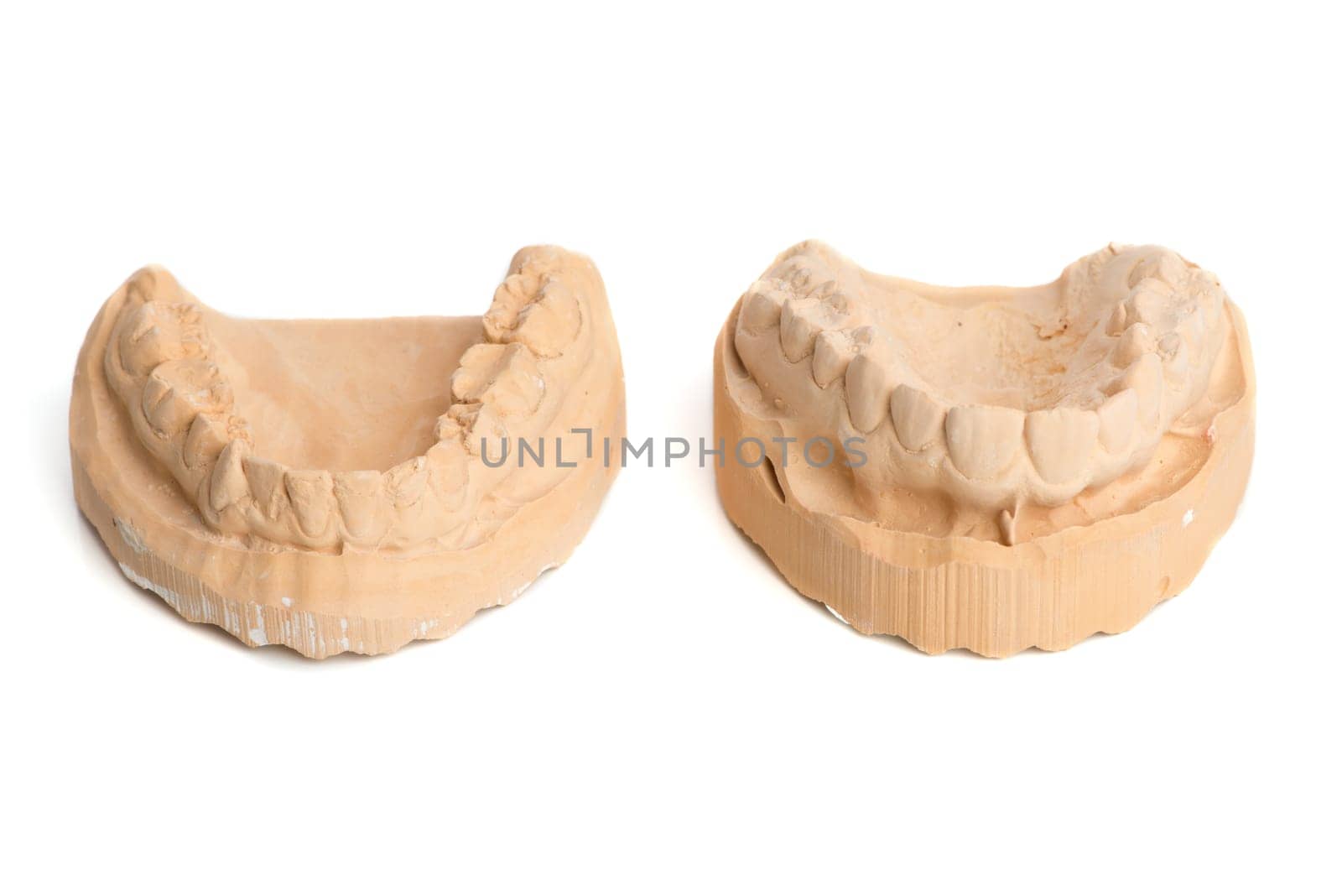 Tooth impression