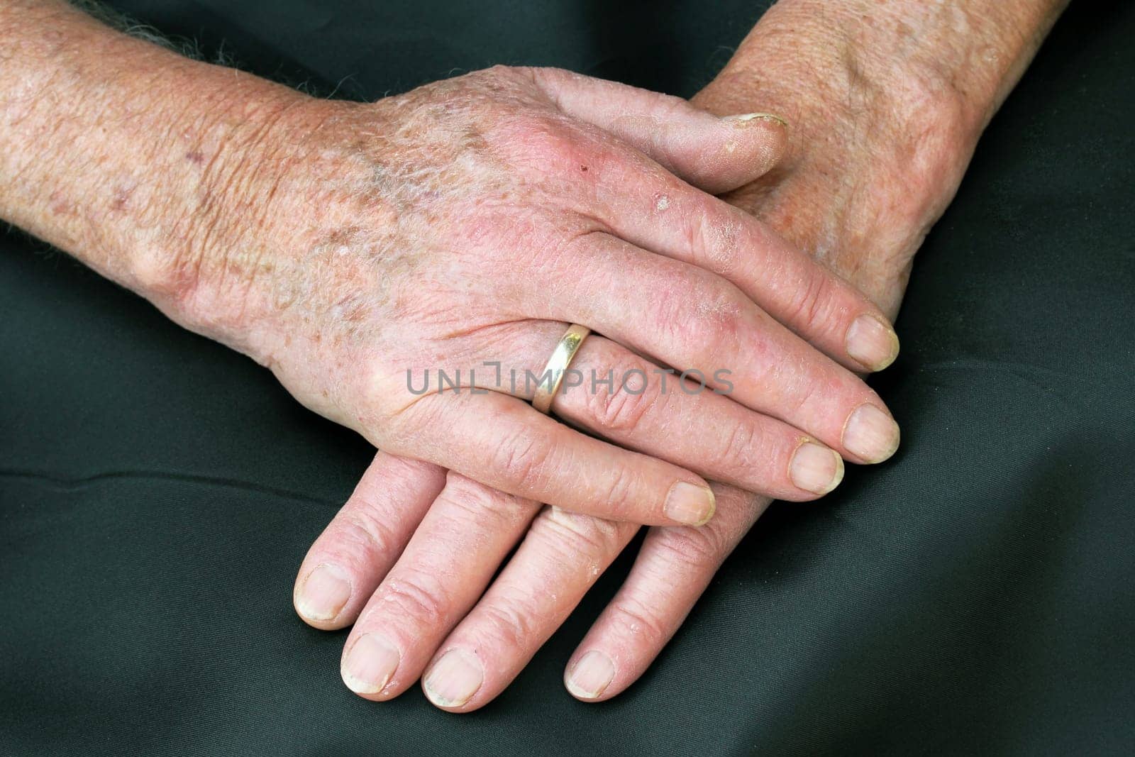 Hands of an old couple