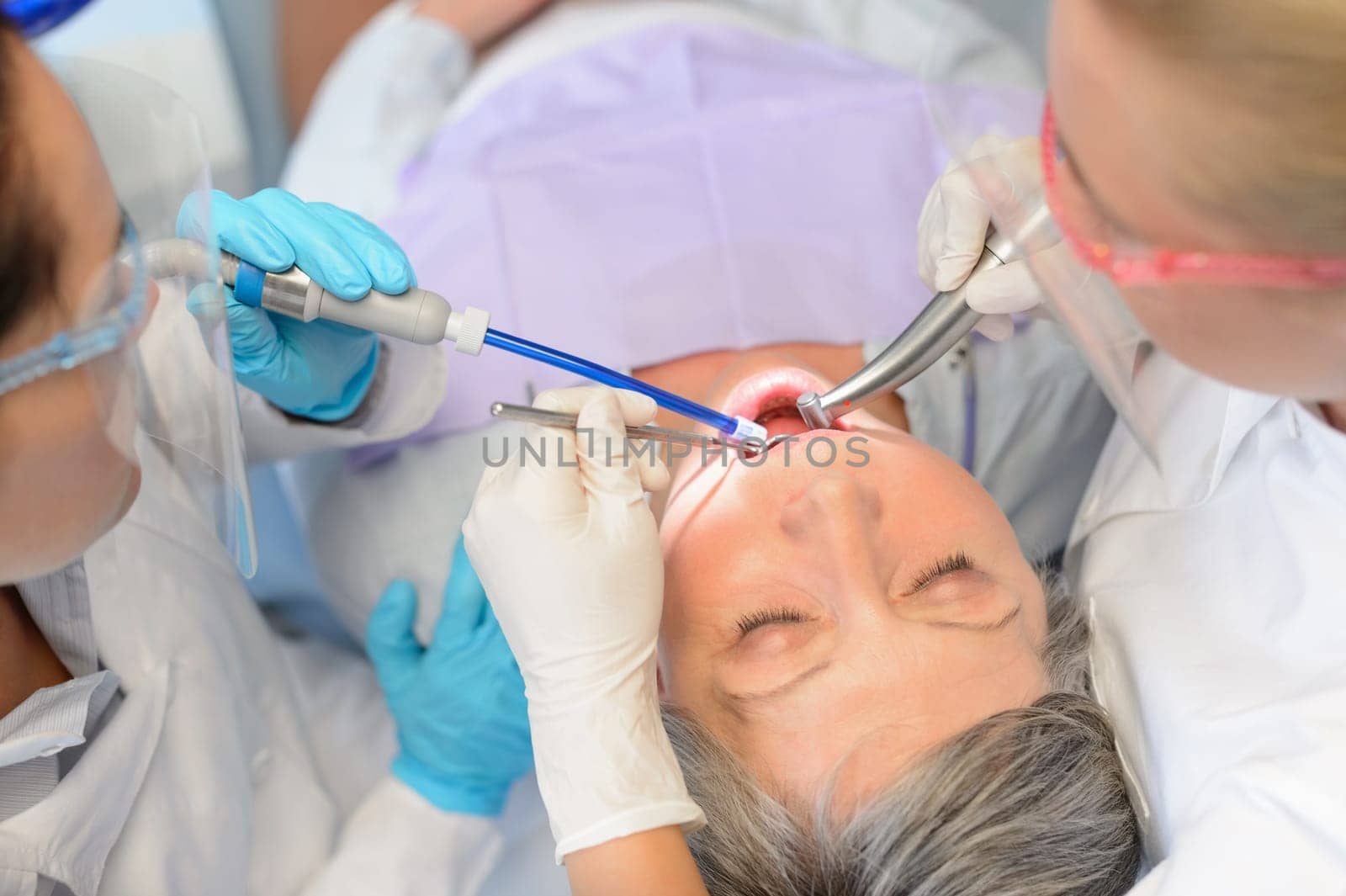 Dental checkup senior patient woman professional dentist team top view