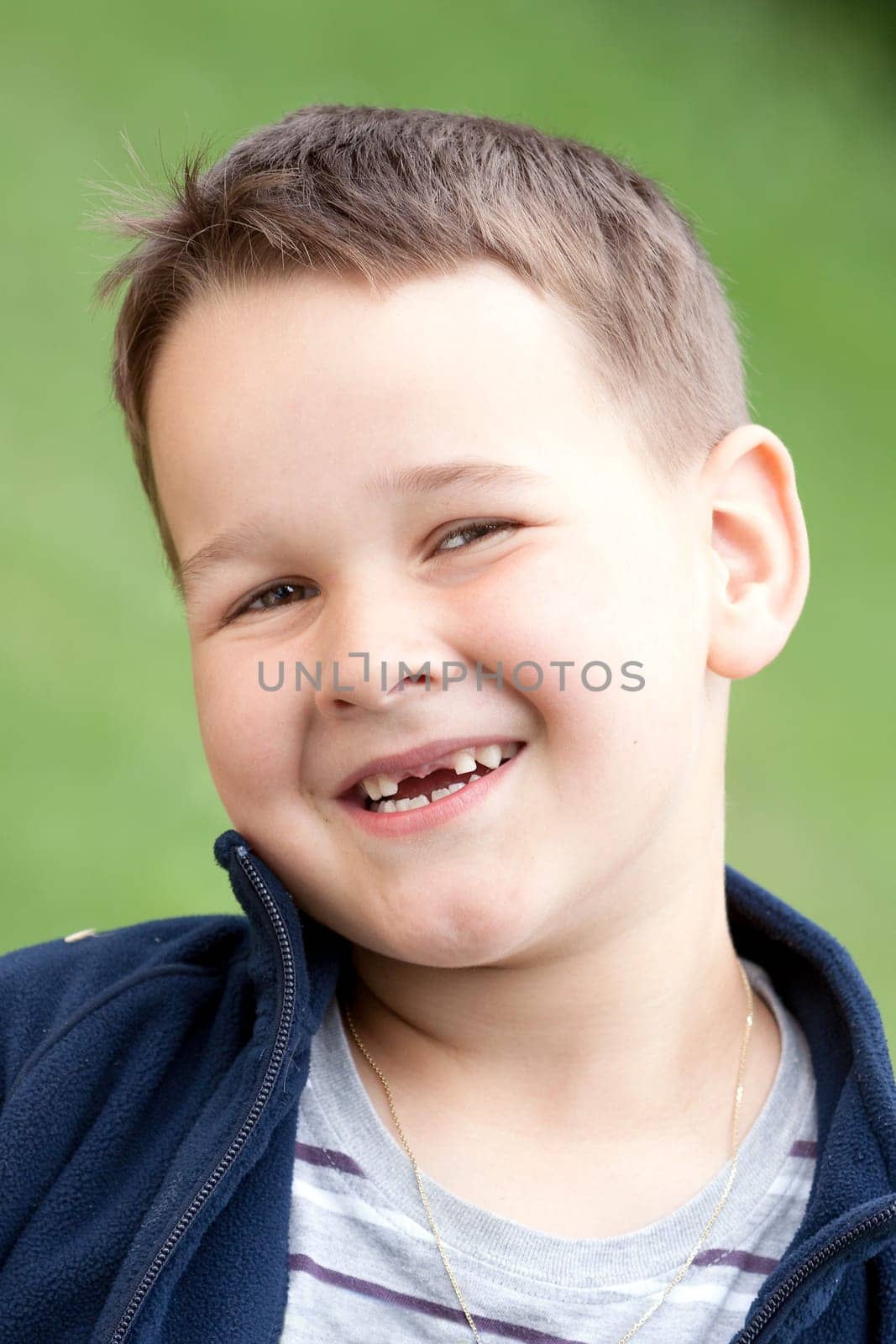 boy outdoors without upper two teeth with smile