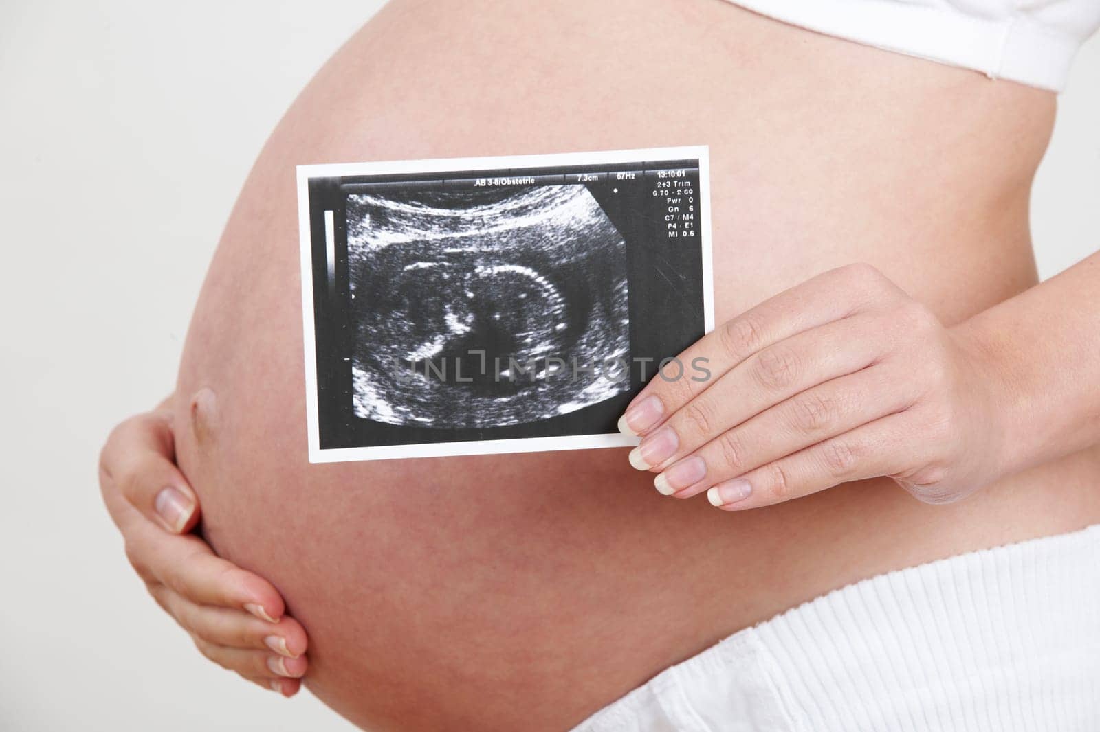 Close Up Of Pregnant Woman Holding Baby Scan
